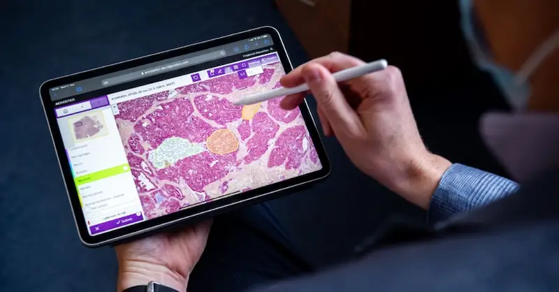 Aignostics raised €14M to transform pathology with AI