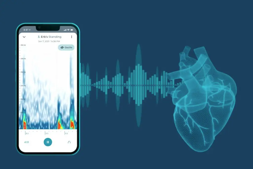 Sparrow BioAcoustics from Newfoundland secures $10M to turn Smartphones into Stethoscopes